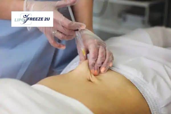 Fat Dissolving Injections Hickstead & Weight loss medication