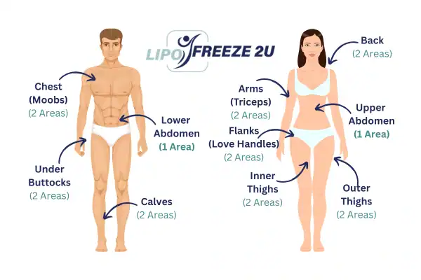 Areas you can have fat freezing treatment Hickstead