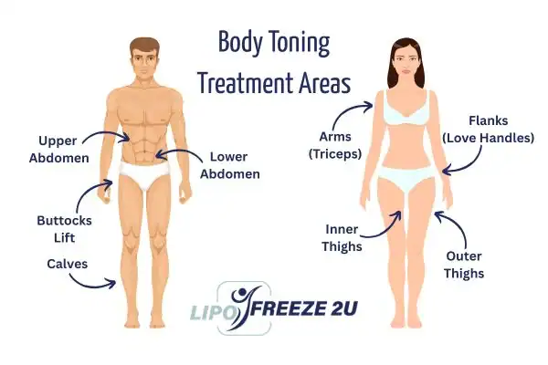 Graphic showing where you can have Body toning Treatment Hickstead on your body
