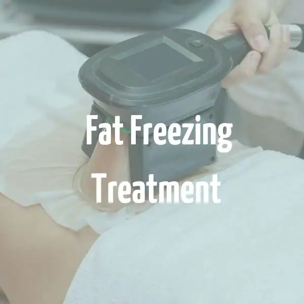 fat freezing treatment Hickstead