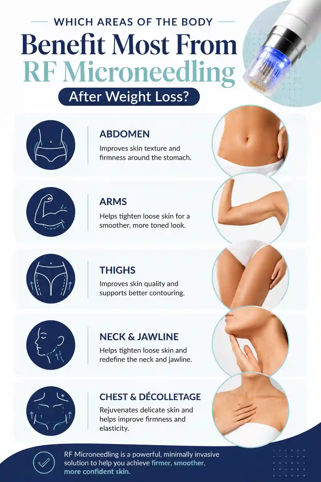 Which Areas of the Body Benefit Most From RF Microneedling After Weight Loss Hickstead